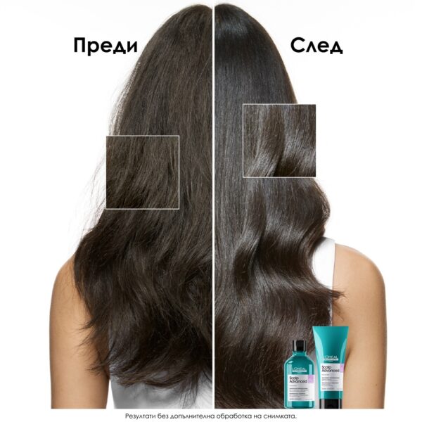 3 Шампоан за чувствителен скалп Scalp Advanced Anti-Discomfort – L'Oréal Professionnel
