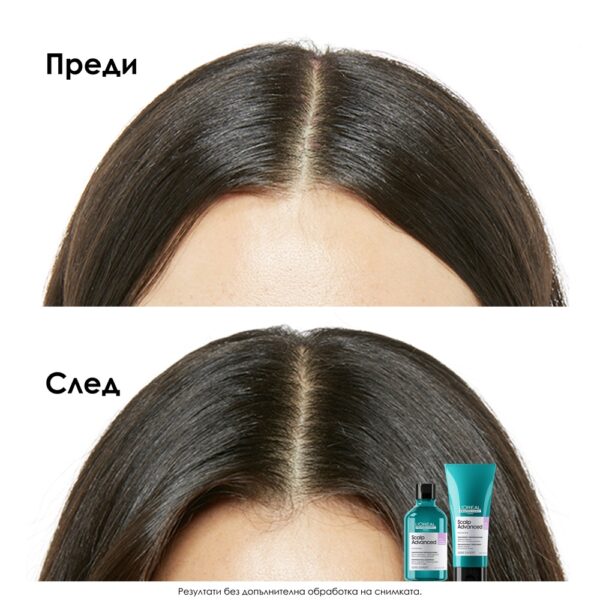 4 Шампоан за чувствителен скалп Scalp Advanced Anti-Discomfort – L'Oréal Professionnel
